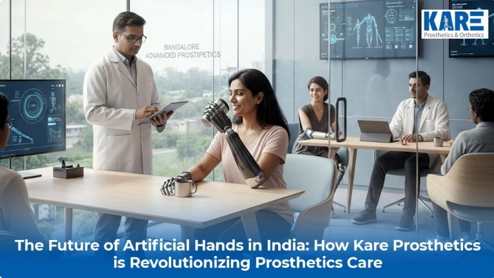 The Future of Artificial Hands in India: How Kare Prosthetics is Revolutionizing Prosthetic Care
